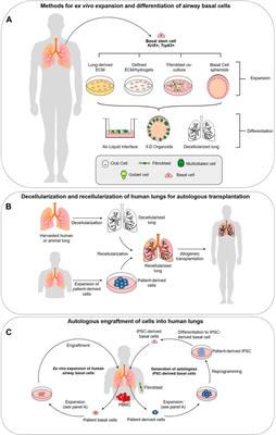 Implications for Extracellular Matrix Interactions With Human Lung Basal Stem Cells in Lung Development, Disease, and Airway Modeling